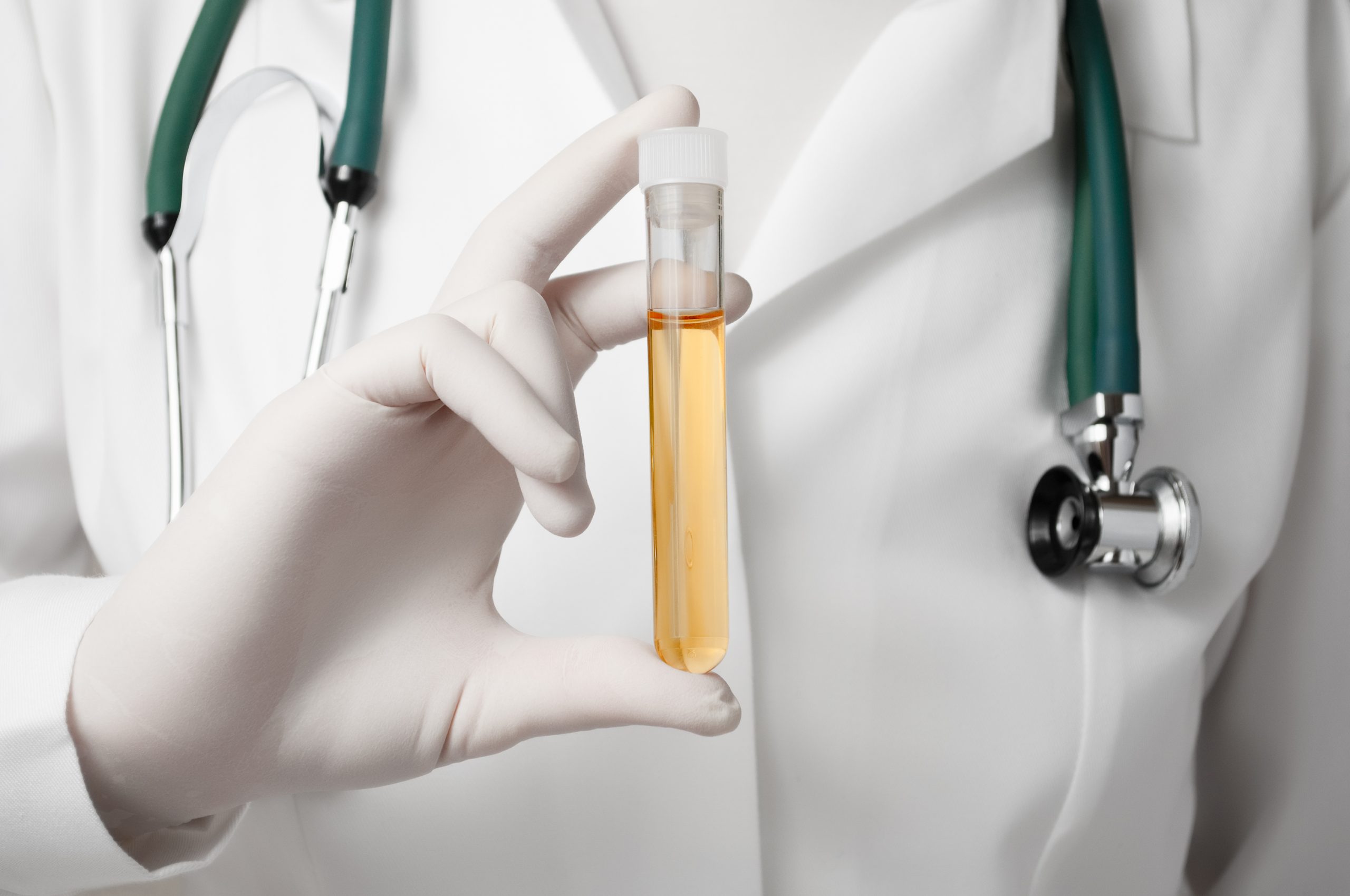 Drug-testing-image-scaled Drug-testing-image-scaled